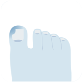 壹醫健  Dr.One 倒甲/嵌甲